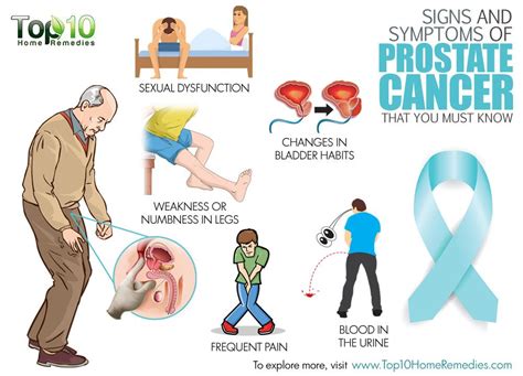 Signos Y Sintomas Del Cancer De Prostata