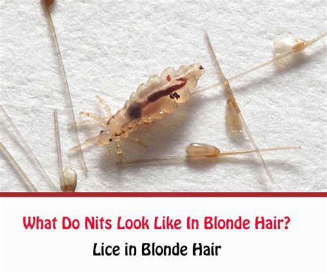 Does lice shampoo kill lice? What Do Nits Look Like In Blonde Hair? | How to Get Rid Of ...