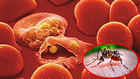 Researchers Describes How Malaria Plasmodium Parasites Preparing