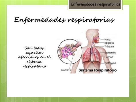 Enfermedades Del Sistema Respiratorio Causas Sintomas Y Tratamientos Images
