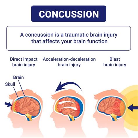 5 Signs Of A Concussion — And What To Do Next