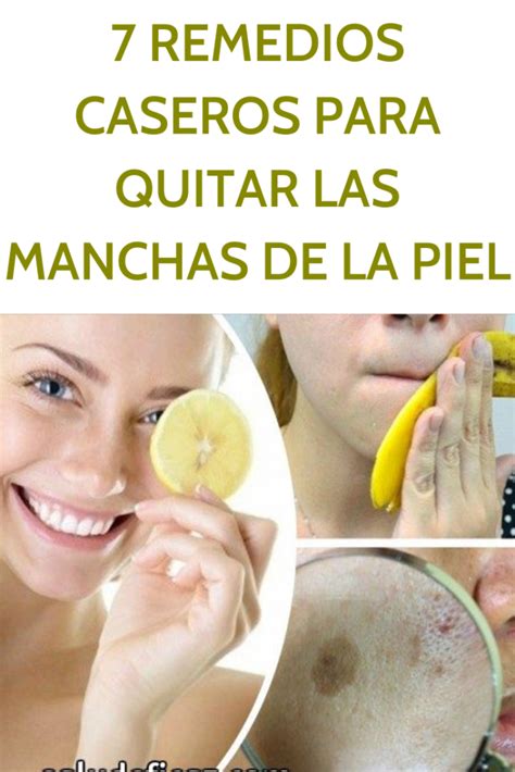 Que Son Las Manchas Eliminar Manchas En La Cara Remedios Naturales My