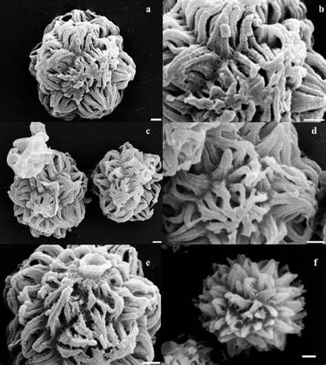 Sem Of Spore Ornamentation Of Selected Pisolithus Collections Bars 1