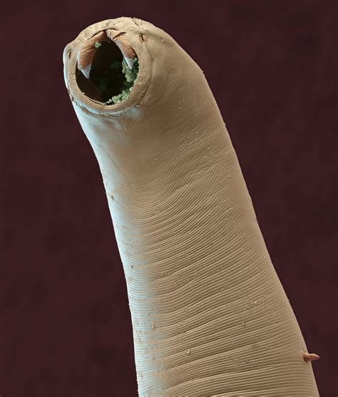 Hookworm In Humans Pictures Photos