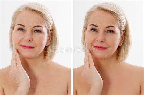 Closeup Before After Beauty Middle Age Woman Face Portrait Before