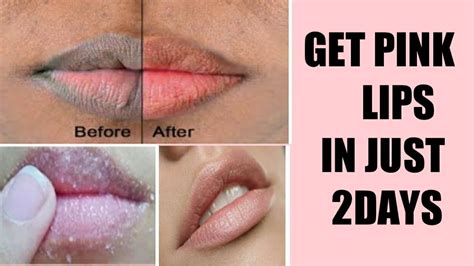 How To Get Pink Lipslighten Dark Lips Naturally At Home Youtube