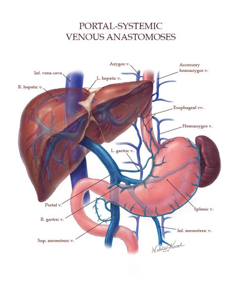 Portal Systemic Venous Anastomoses Art As Applied To Medicine