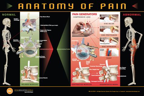 Anatomy Of Pain Poster By Dynamic Disc Designs
