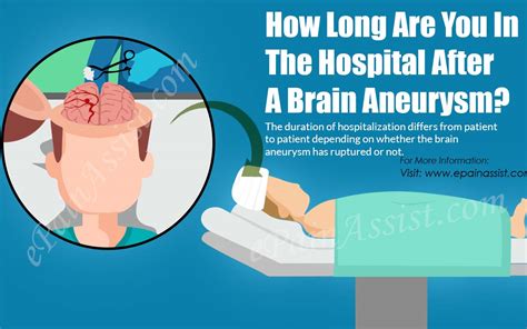 How Long Are You In The Hospital After A Brain Aneurysm