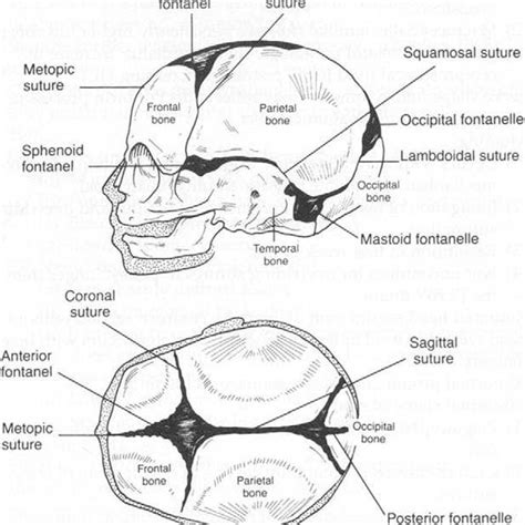 Infant Skull Anatomy Reprinted With Permission From Furdon Sa