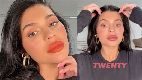 Kylie Jenner Gets More Lip Fillers Beauty Moguls ‘totally Different