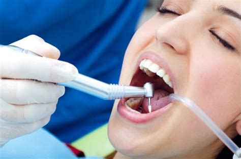 ¿qué Es Un Curetaje Dental Y Para Qué Sirve Domus Dental