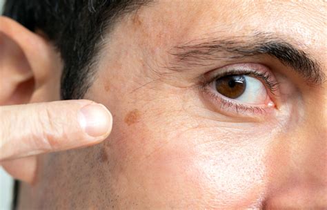 Procedures Facial Trauma Facial Skin Cancer And Reconstruction Dr