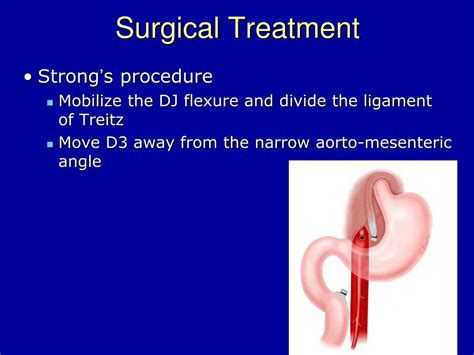 superior mesenteric artery sma syndrome