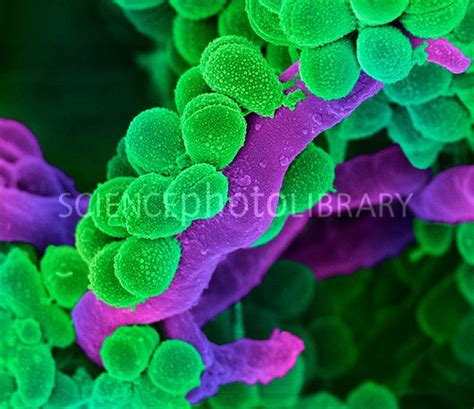 Oral Streptococcus Bacteria Coloured Scanning Electron Micrograph Sem