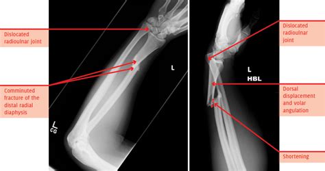 The Unofficial Guide To Radiology Practice Orthopaedic X Rays