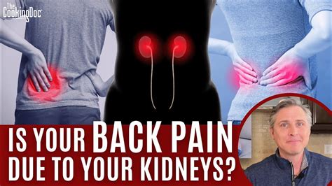 Is Your Back Pain Due To Your Kidneys The Cooking Doc® Youtube