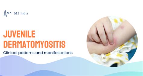 Disease Patterns Of Juvenile Dermatomyositis