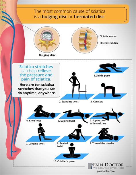 Infographic Sciatica Stretches Sciatica Stretches Sciatica Pain