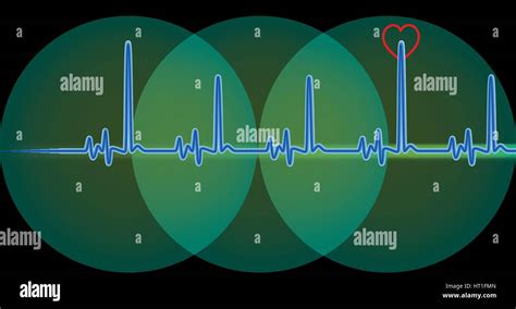 Ekg Cardiogram Monitor Heartbeat Fotos Und Bildmaterial In Hoher