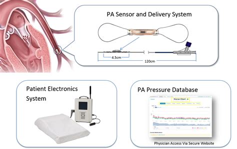 Fda Approves Implantable Wireless Heart Monitoring Device Fedscoop