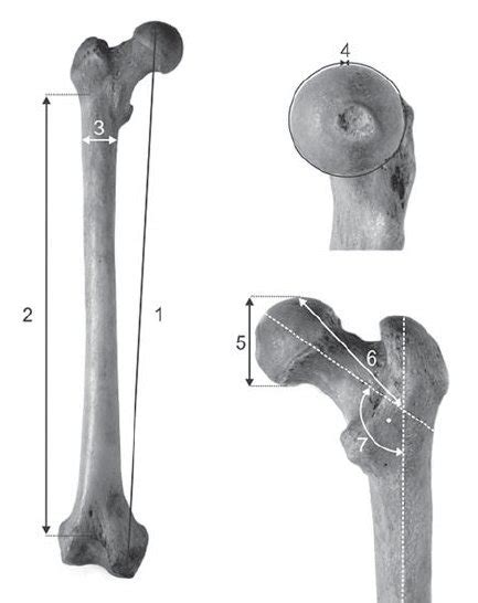 Osteometric Measurements Of The Human Femur 1 — Greatest Femur Length