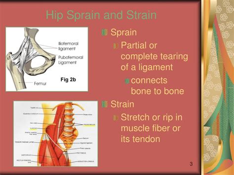 Tendon Connecting Leg To Groin Causes Of Hip Pain In Women And Simple