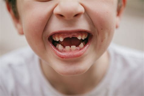 When Do Kids Start Losing Teeth Expert Guide To Baby Teeth