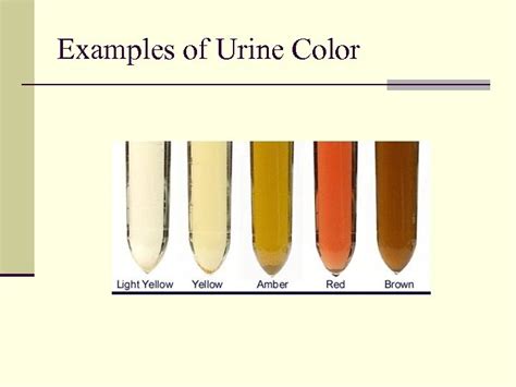 Urine Color Chart Urine Varies In Appearance Depending Principally