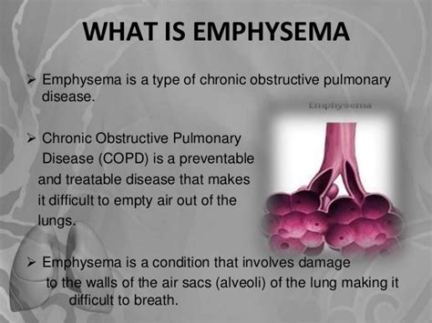 Emphysema Infographic