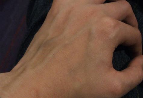 Do You Have Veiny Hands 7 Causes Why Veins Pop Out
