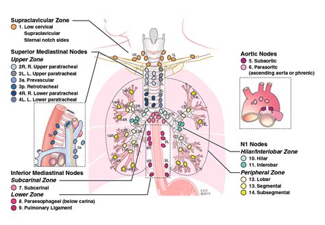 Mediastinal Lymph Node Staging From Noninvasive To Surgical Ajr