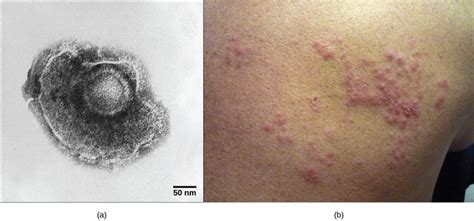 Viral Infectious Cycles Biology For Non Majors I