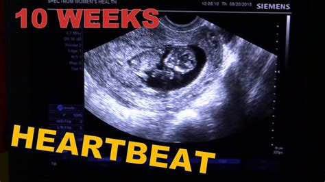 ️ 10 Weeks Pregnant Ultrasound Heartbeat ️ Early Pregnancy Usg Baby