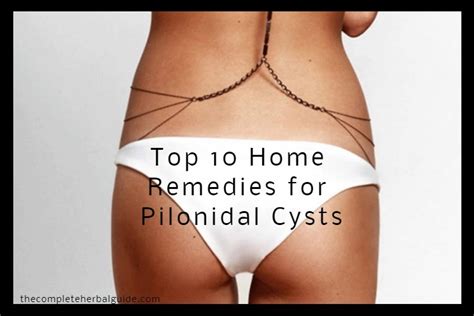 Top 10 Home Remedies For Pilonidal Cysts