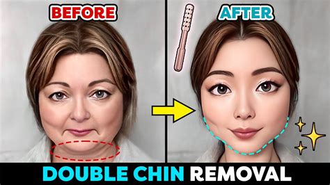 Face Roller For Double Chin Before And After Instant Results No Surgery