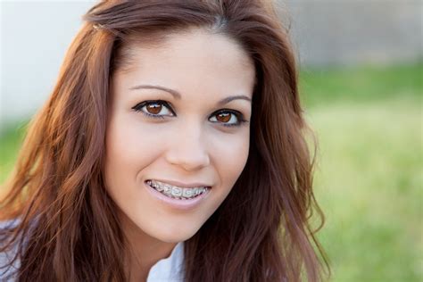 Braces For Adults In Colorado Springs Co Bailey Orthodontics