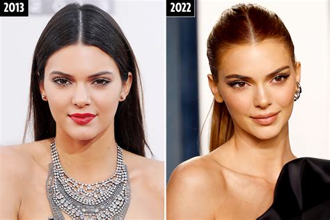 i m a plastic surgeon kendall jenner may have spent up to 45 000 on secret surgery here are