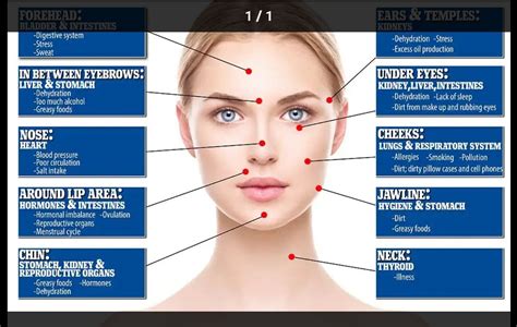 Pin By Audrey Herman On Holistic Home Remedies Face Mapping Acne