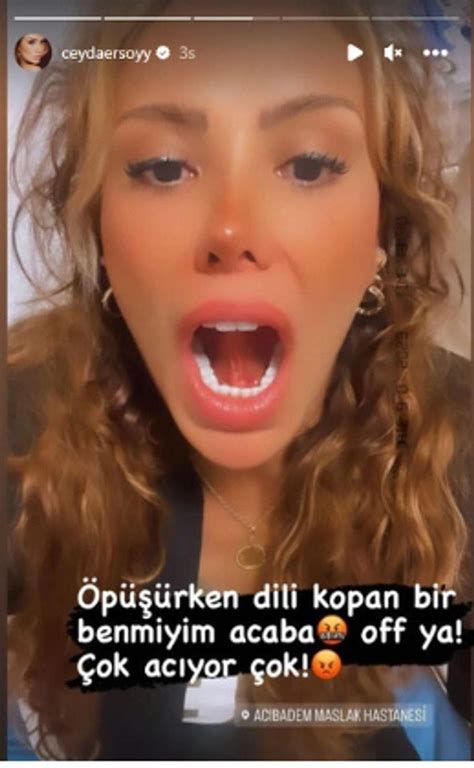 Öpüşürken Dili Kopan Ciciş Ceyda Ersoyun Hastane Videosu Gündem Oldu