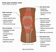 Knee pain location chart: Sites of different injuries