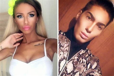 Barbie And Ken Couple Deny Having Plastic Surgery Daily Star