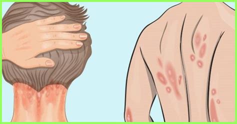 The vitamin d council says your body can produce 10,000 to 25,000 iu of vitamin d in about half the time it takes for your skin to begin to burn. Vitamin D Deficiency - Causes, Symptoms And Treatment