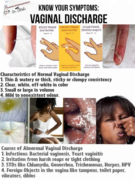 what does abnormal vaginal discharge look like