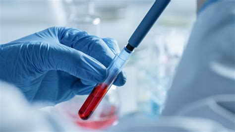Premiers Essais Cliniques De Transfusions De Globules Rouges Cultivés