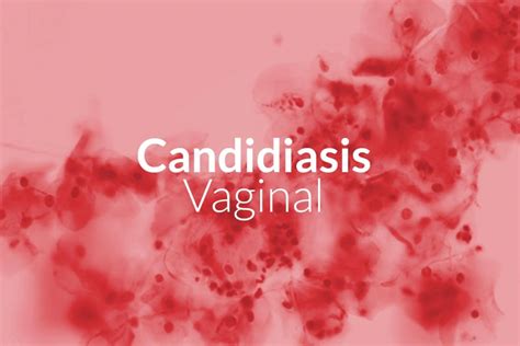 Historia Natural De La Enfermedad Candididasis Vaginal Kulturaupice