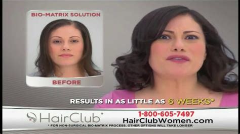 Hair Club Tv Spot Trusted Hair Loss Solution Ispottv