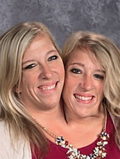 Inside Conjoined Twins Abby And Brittany Hensels Quiet Life Today