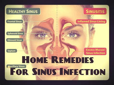 6 Natural Home Remedies For A Sinus Infection Me First Living