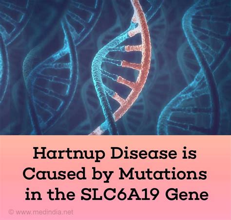Hartnup Disease Causes Symptoms Diagnosis Treatment And Prevention